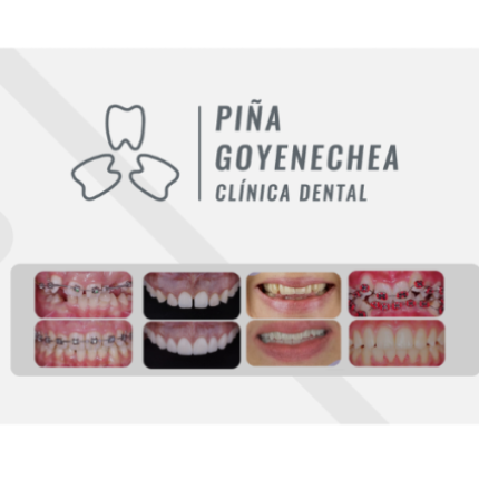 Clínica Dental Ortodoncia Invisible