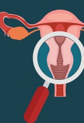 Prevención del cáncer cervicouterino a través de la Colposcopia - Gineco Obstetra Dra. Ma. de Lourdes Lima Baéz.