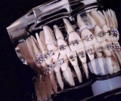 Ateción personalizada - Medidental - Clínica Dental