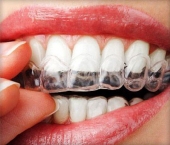 Confort y tranquilidad en cada visita - Medidental - Clínica Dental