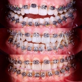Especialista en rehabilitación bucal y ortodoncia - Medidental - Clínica Dental
