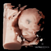  - Ultramedica Ecografía - Dr. Salvador Arellano Roldán