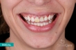 smilecare