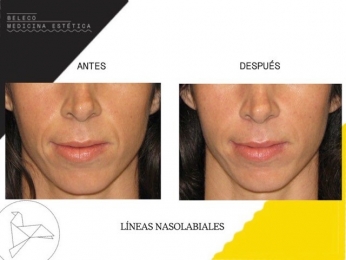 Beleco - Medicina Estética - Puebla