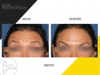 Beleco - Medicina Estética - Puebla