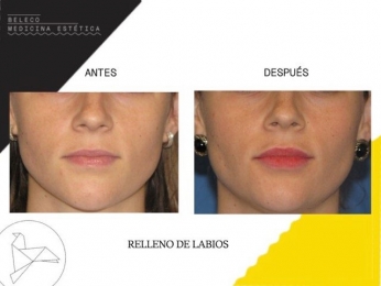 Beleco - Medicina Estética - Puebla