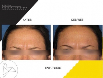 Beleco - Medicina Estética - Puebla