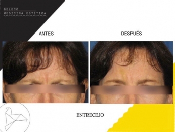 Beleco - Medicina Estética - Puebla