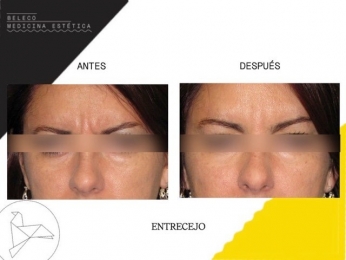 Beleco - Medicina Estética - Puebla