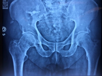 Ortopedista - Dr. Cristian Rivera Reyes - Puebla