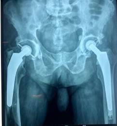 Ortopedista - Dr. Cristian Rivera Reyes - Puebla