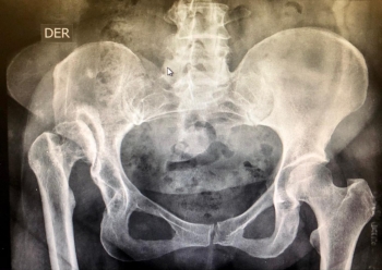 Ortopedista - Dr. Cristian Rivera Reyes - Puebla