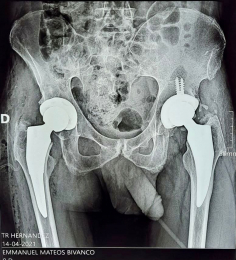 Ortopedista - Dr. Cristian Rivera Reyes - Puebla
