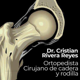 Ortopedista - Dr. Cristian Rivera Reyes - Puebla