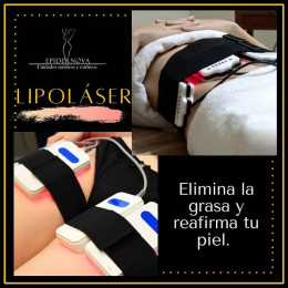Es una técnica que permite realizar procedimientos para eliminación de grasa, moldeamiento corporal ...