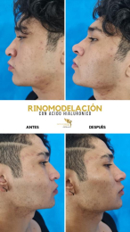 Cirugía estética y Bariatría en Puebla - Dr. Mario Salazar Olivares - Puebla