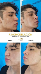 Cirugía estética y Bariatría en Puebla - Dr. Mario Salazar Olivares - Puebla